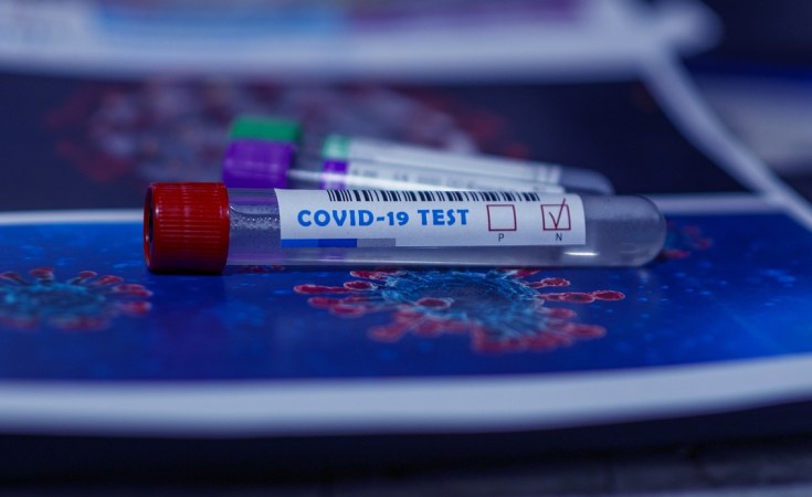 Rwanda to Start Rapid Antigen Tests for Covid-19